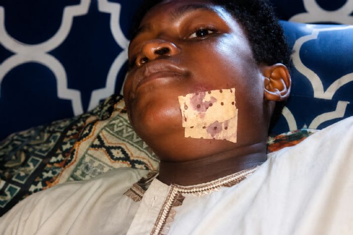 Mâchoire cassée par des militaires lors des manifestations : Nayed, 14 ans, a besoin de votre aide