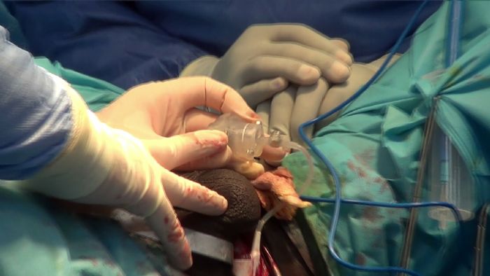 Troubles d’érection : les avancées médicales qui redonnent espoir - SRTB